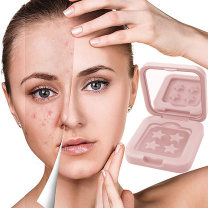 60 Acne Patch, Alcohol and Fragrance Free, Covering Acne and blemishes, Facial and Skin Spot Patch, Luxury Makeup Mirror by All Mart Bristol Ltd
