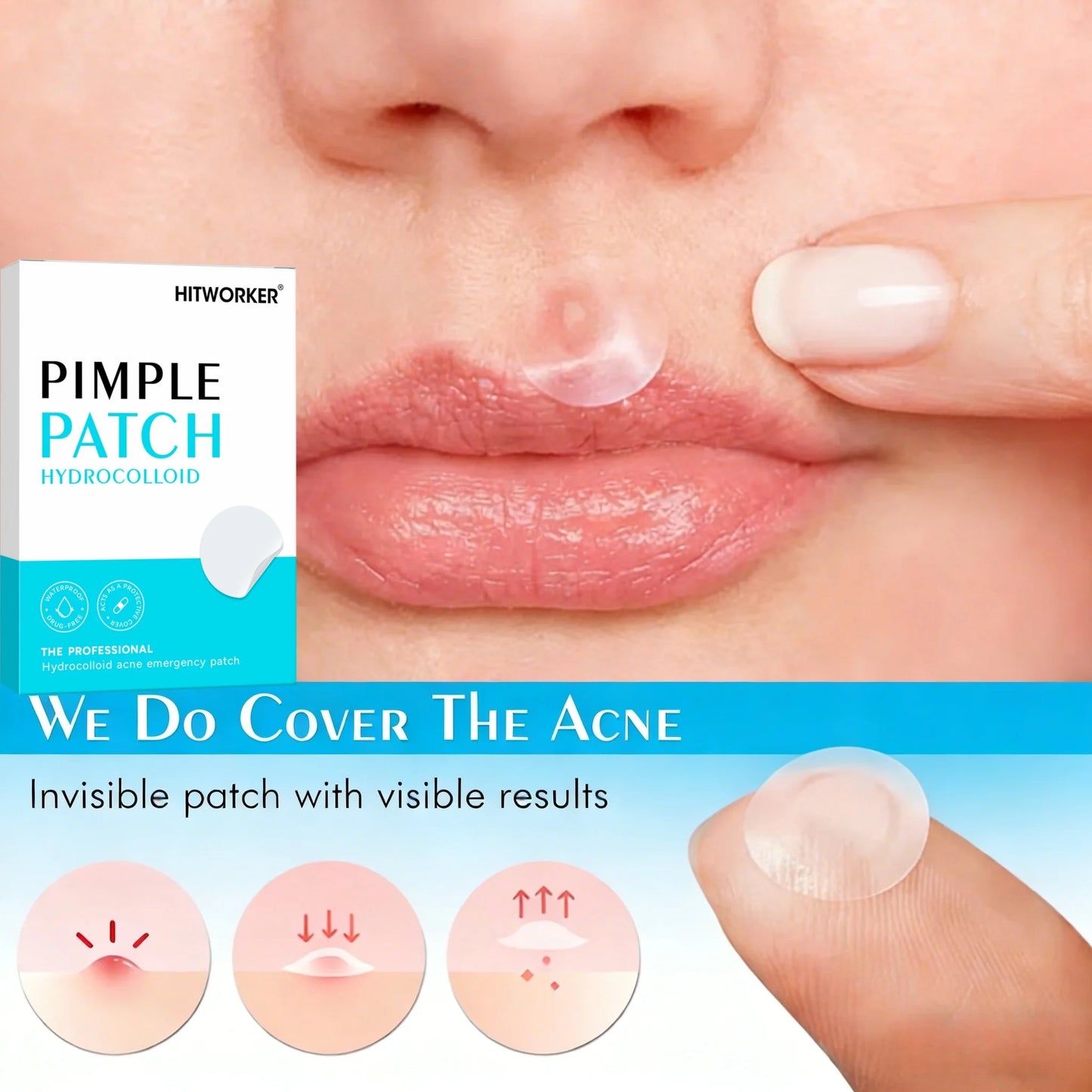 144/360/720pcs Hydrocolloid Acne Pimple Patches for Face, Effective Blemish Spot Treatment, Invisible & Skin-Friendly by All Mart Bristol Ltd