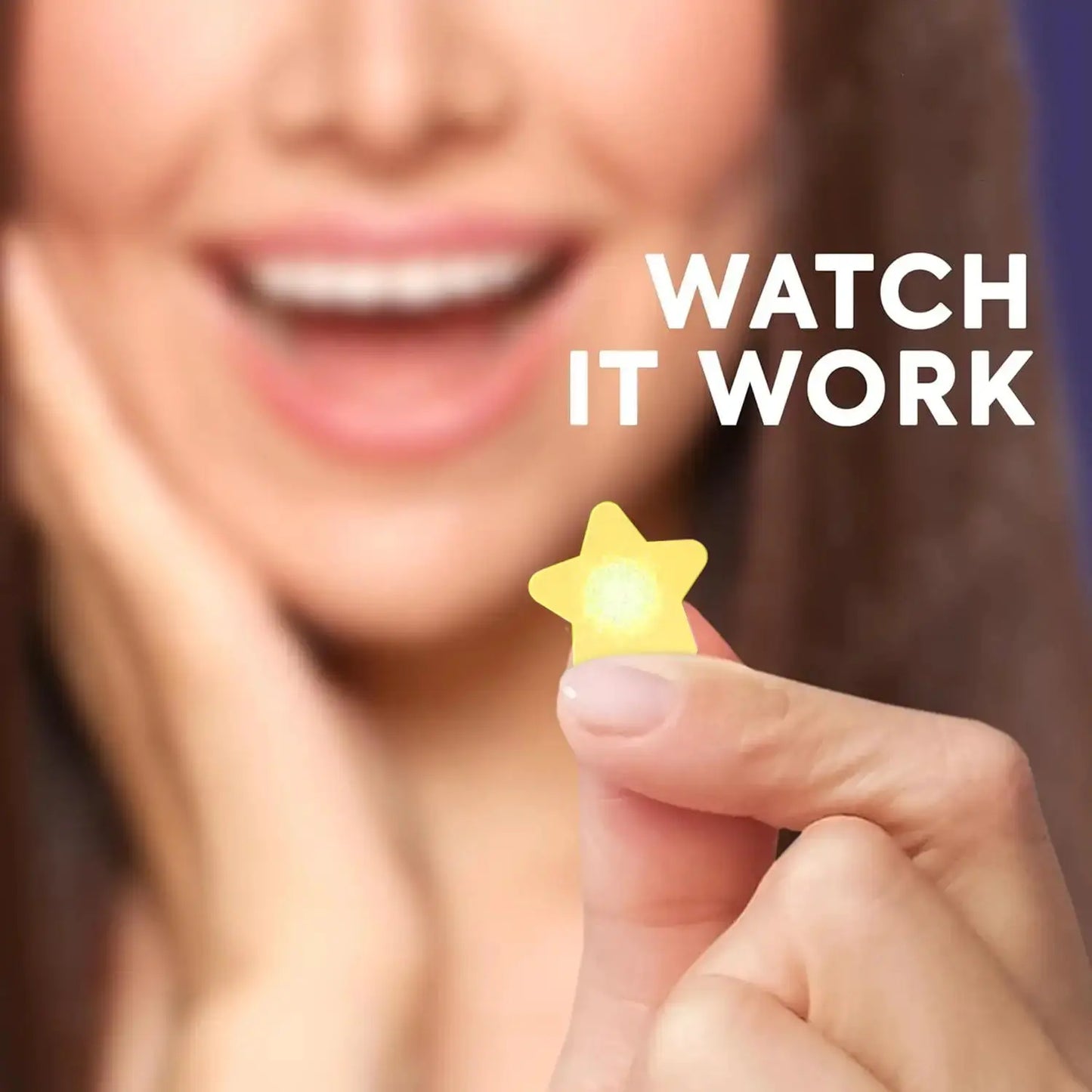 Star Acne Patches 240/480/720 Pieces, High-Quality Emergency Kit, Invisible Hydrogel Absorbs Pus Quickly, Reduces Swelling, Cute by All Mart Bristol Ltd