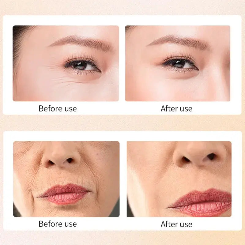 2025 Korean Snail Collagen Anti-Wrinkle Serum Anti Aging Skincare for Wrinkles Firming Lifting Protect Repair Aging Skin Care by All Mart Bristol Ltd