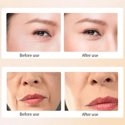 2025 Korean Snail Collagen Anti-Wrinkle Serum Anti Aging Skincare for Wrinkles Firming Lifting Protect Repair Aging Skin Care by All Mart Bristol Ltd