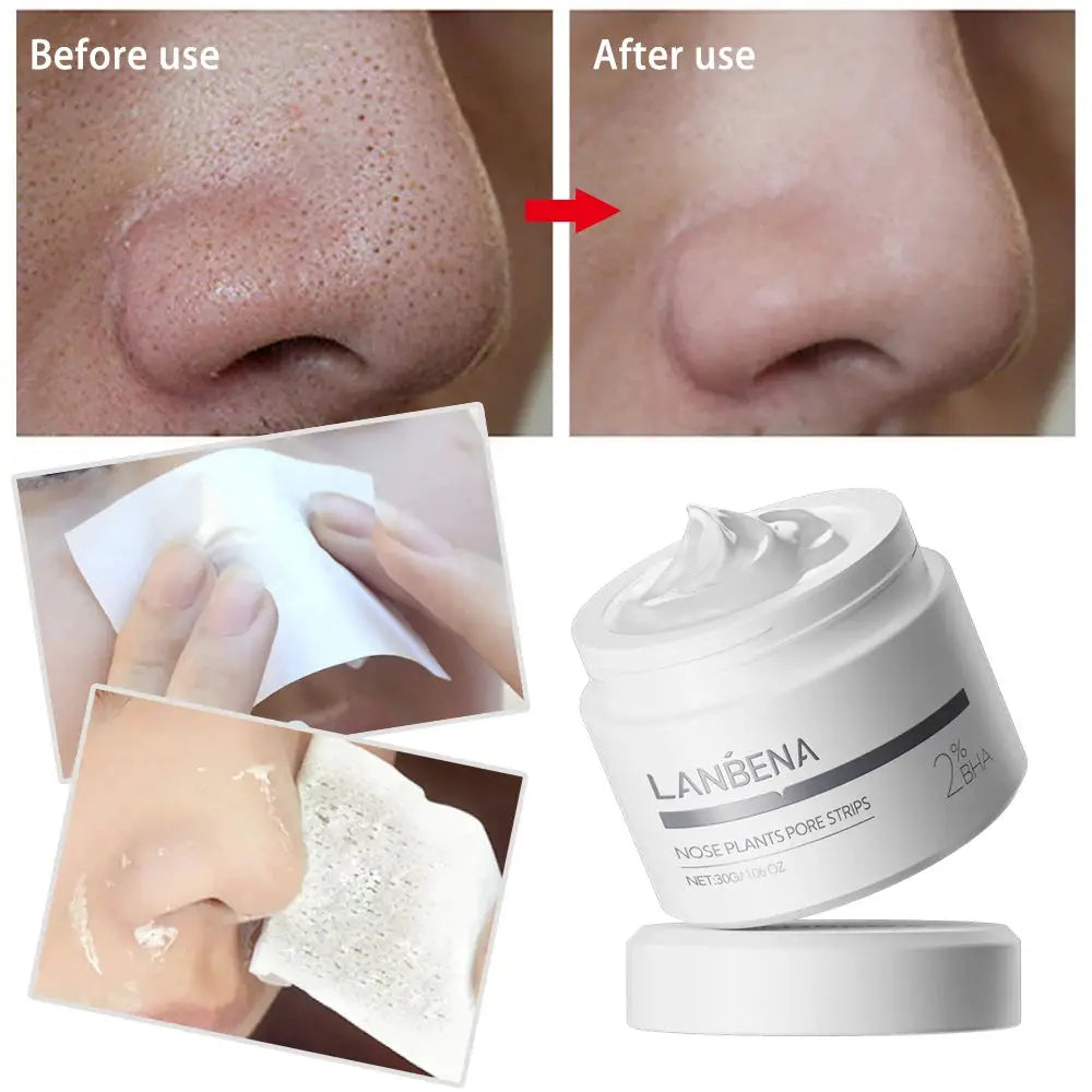 LANBENA New Style Blackhead Remover Nose Mask Pore Strip Black Mask Peeling Black Deep Cleansing Skin Care Beauty Health by All Mart Bristol Ltd