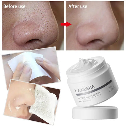 LANBENA New Style Blackhead Remover Nose Mask Pore Strip Black Mask Peeling Black Deep Cleansing Skin Care Beauty Health by All Mart Bristol Ltd