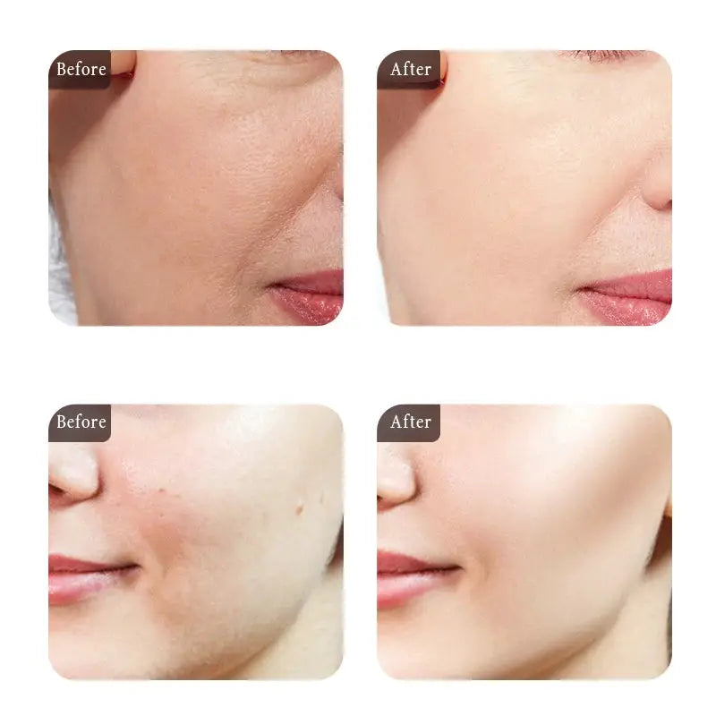 Moisturizing Face Serum and Cream Brighten Firming Anti-wrinkle Collagen Pre-Essence Caviar Eye Cream Dark Circle Eyebag Remover by All Mart Bristol Ltd