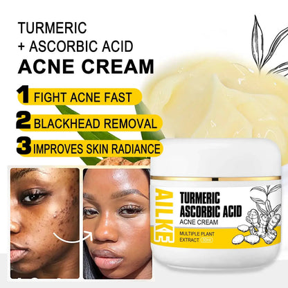 AILKE Organic Turmeric Lightening Skin Care Set, Reduce Acne, Improve Dullness, Hydration, Exfoliate, Clean and Smooths Skin by All Mart Bristol Ltd