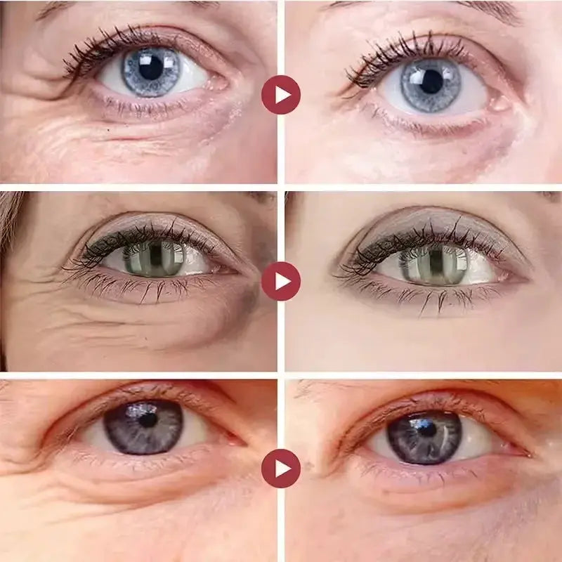 Instant Eye Bag Remove Cream Retinol Anti-Wrinkle Firming Skin Fade Fine Lines Anti Dark Circle Puffiness Brighten Eye SkinCare by All Mart Bristol Ltd