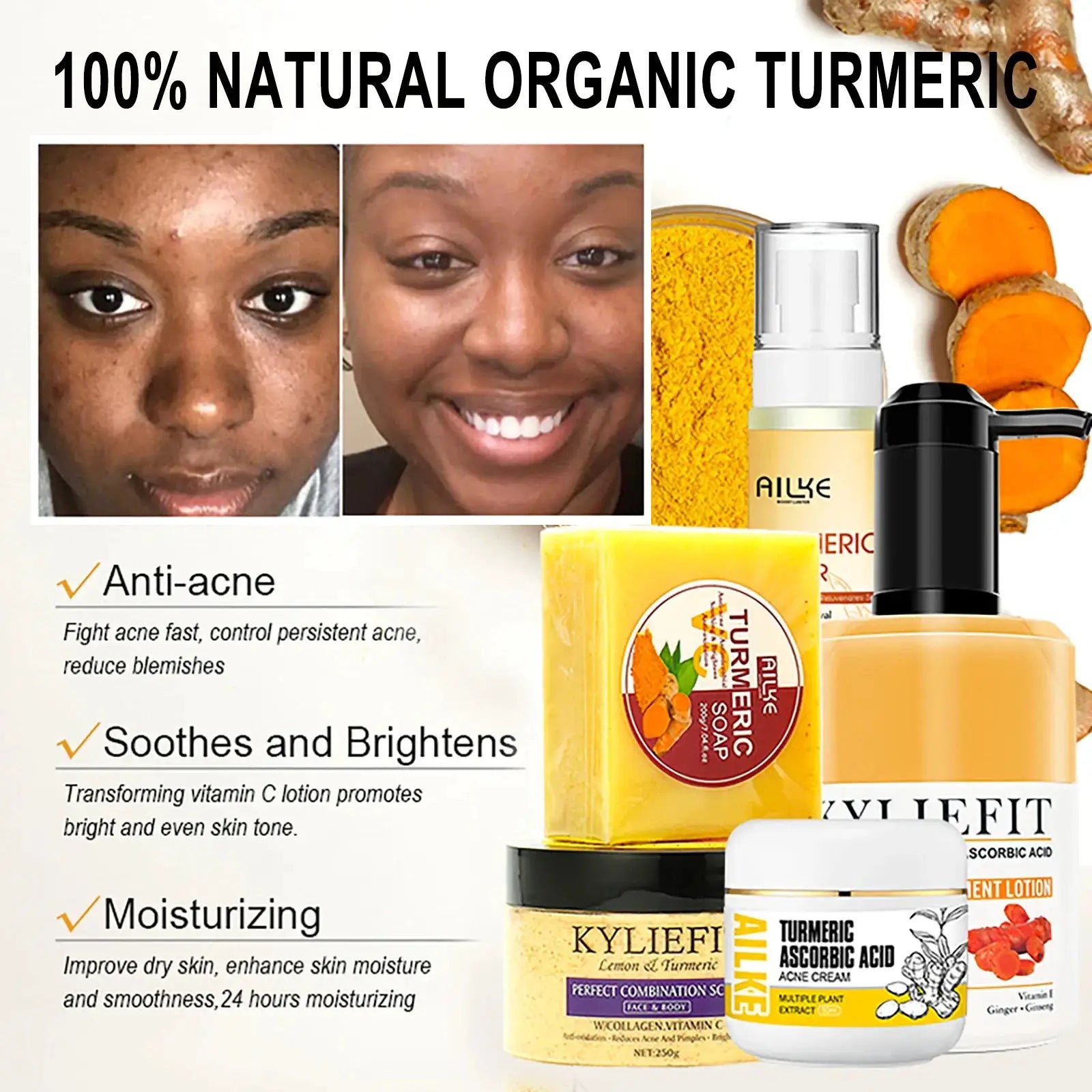 AILKE Organic Turmeric Lightening Skin Care Set, Reduce Acne, Improve Dullness, Hydration, Exfoliate, Clean and Smooths Skin by All Mart Bristol Ltd