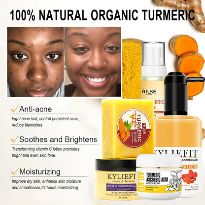 AILKE Organic Turmeric Lightening Skin Care Set, Reduce Acne, Improve Dullness, Hydration, Exfoliate, Clean and Smooths Skin by All Mart Bristol Ltd