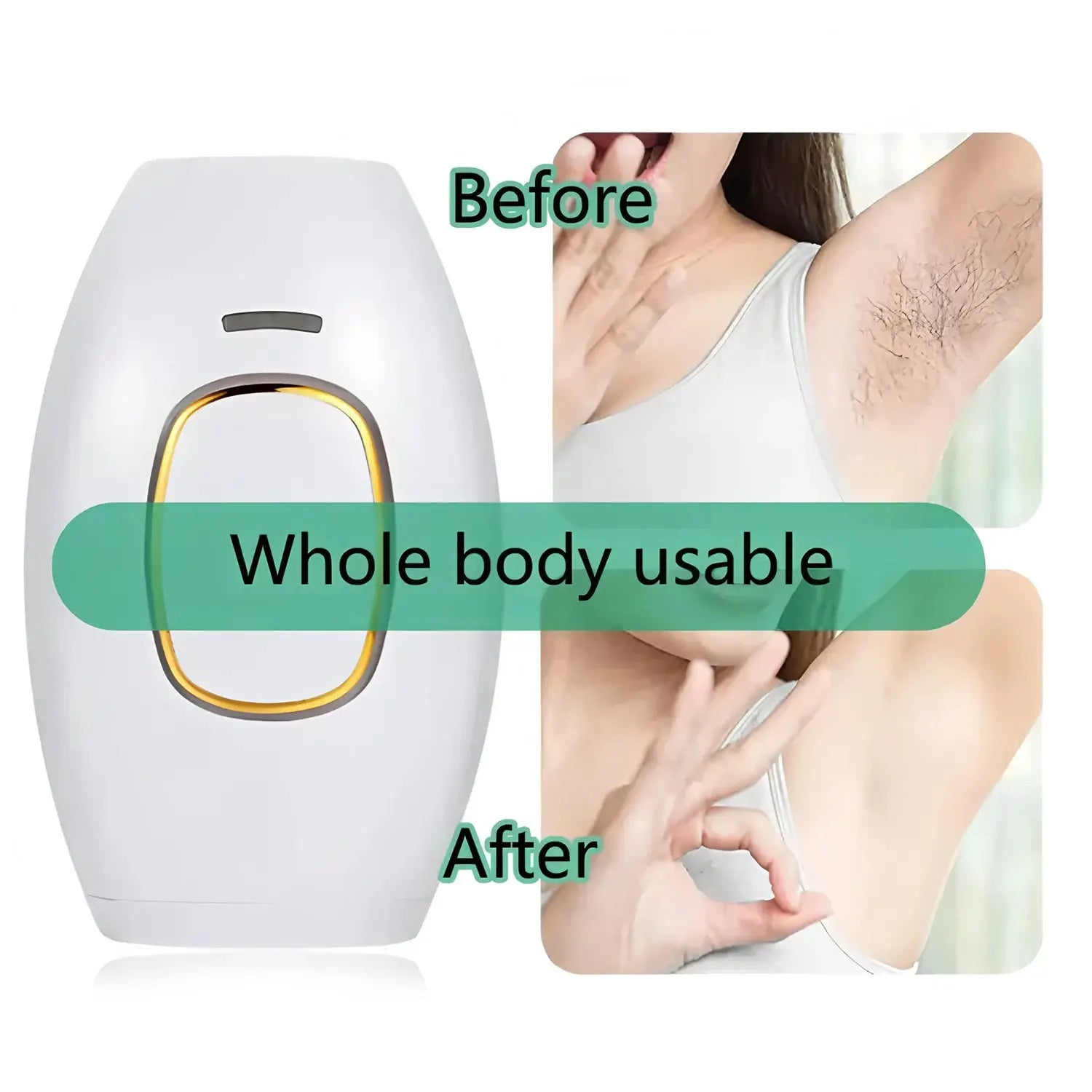 Home Use IPL Laser Hair Removal Device 500000 Flashes by All Mart Bristol Ltd