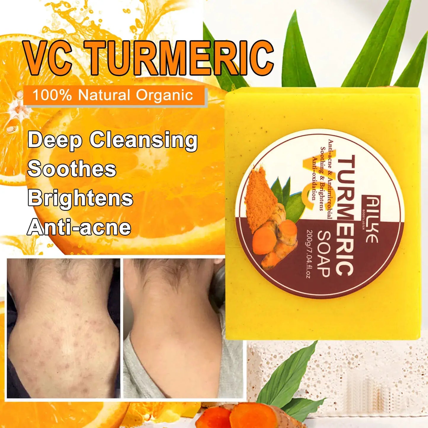 AILKE Organic Turmeric Lightening Skin Care Set, Reduce Acne, Improve Dullness, Hydration, Exfoliate, Clean and Smooths Skin by All Mart Bristol Ltd