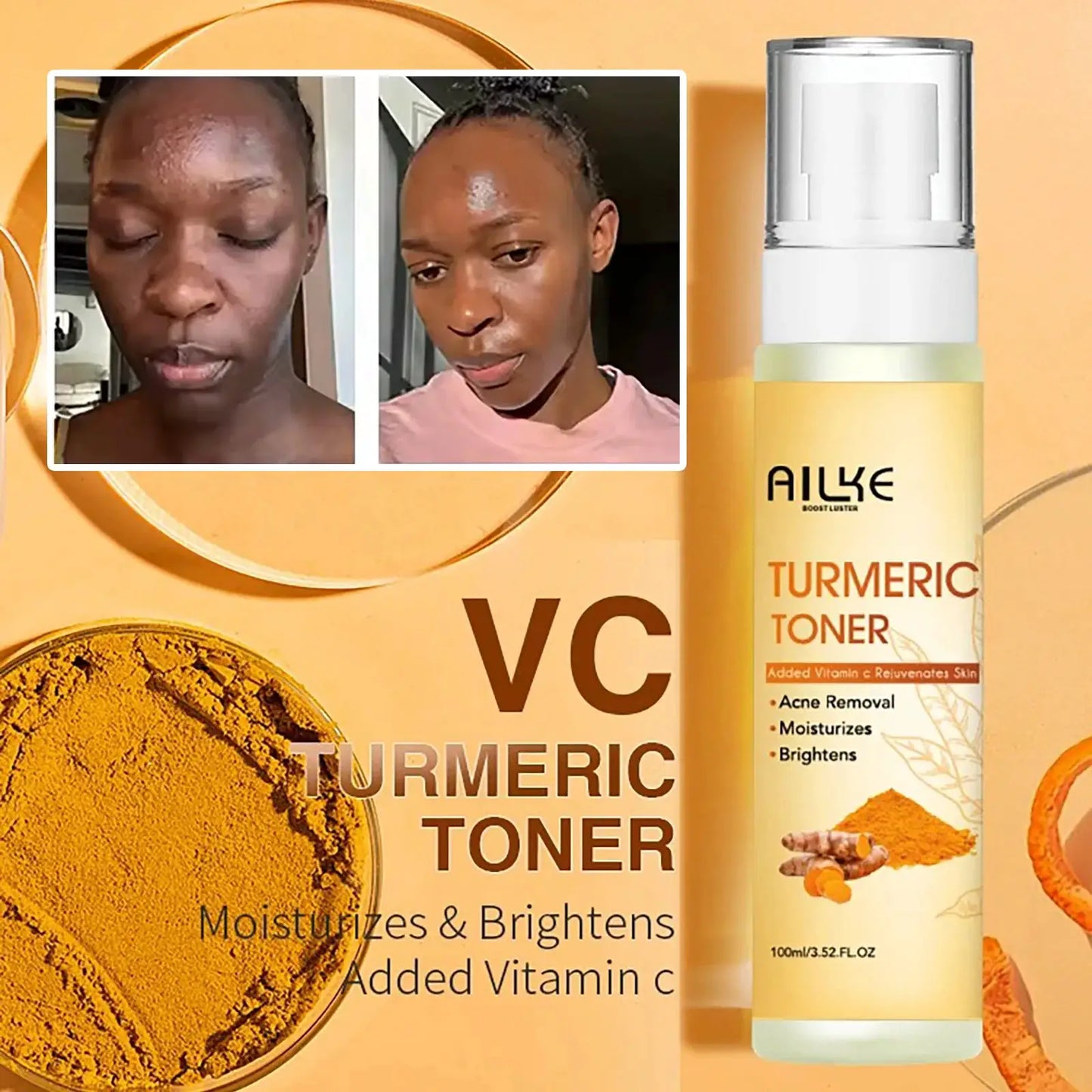 AILKE Organic Turmeric Lightening Skin Care Set, Reduce Acne, Improve Dullness, Hydration, Exfoliate, Clean and Smooths Skin by All Mart Bristol Ltd
