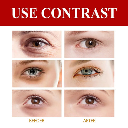 Anti Wrinkle Eye Cream Remove Eye Bags Puffiness Lifting Firming Smooth Skin Care Moisturizing Instant Eye Massage Cream by All Mart Bristol Ltd