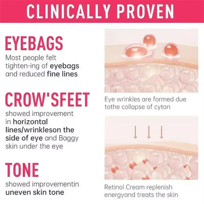 Instant Eye Bag Remove Cream Retinol Anti-Wrinkle Firming Skin Fade Fine Lines Anti Dark Circle Puffiness Brighten Eye SkinCare by All Mart Bristol Ltd
