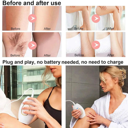 Home Use IPL Laser Hair Removal Device 500000 Flashes by All Mart Bristol Ltd