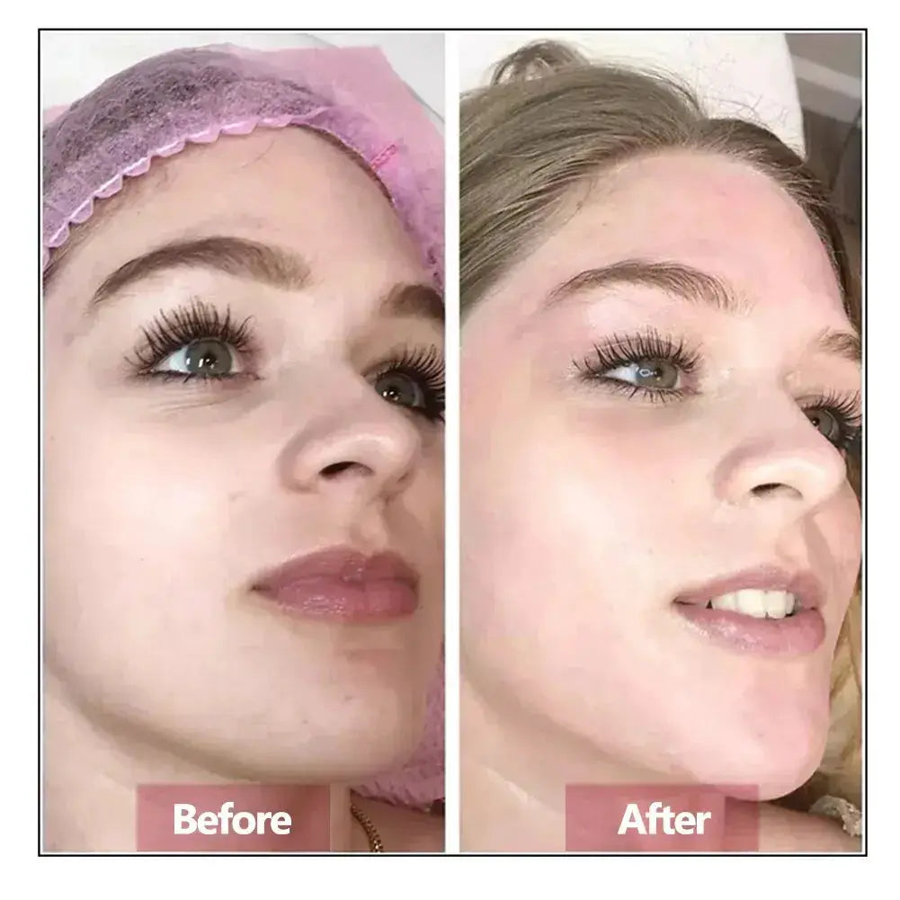 Hyaluronic Acid Face Serum Essence Skin Repair Rejuvenation Firming Moisturizing Hydrating Anti Aging by All Mart Bristol Ltd