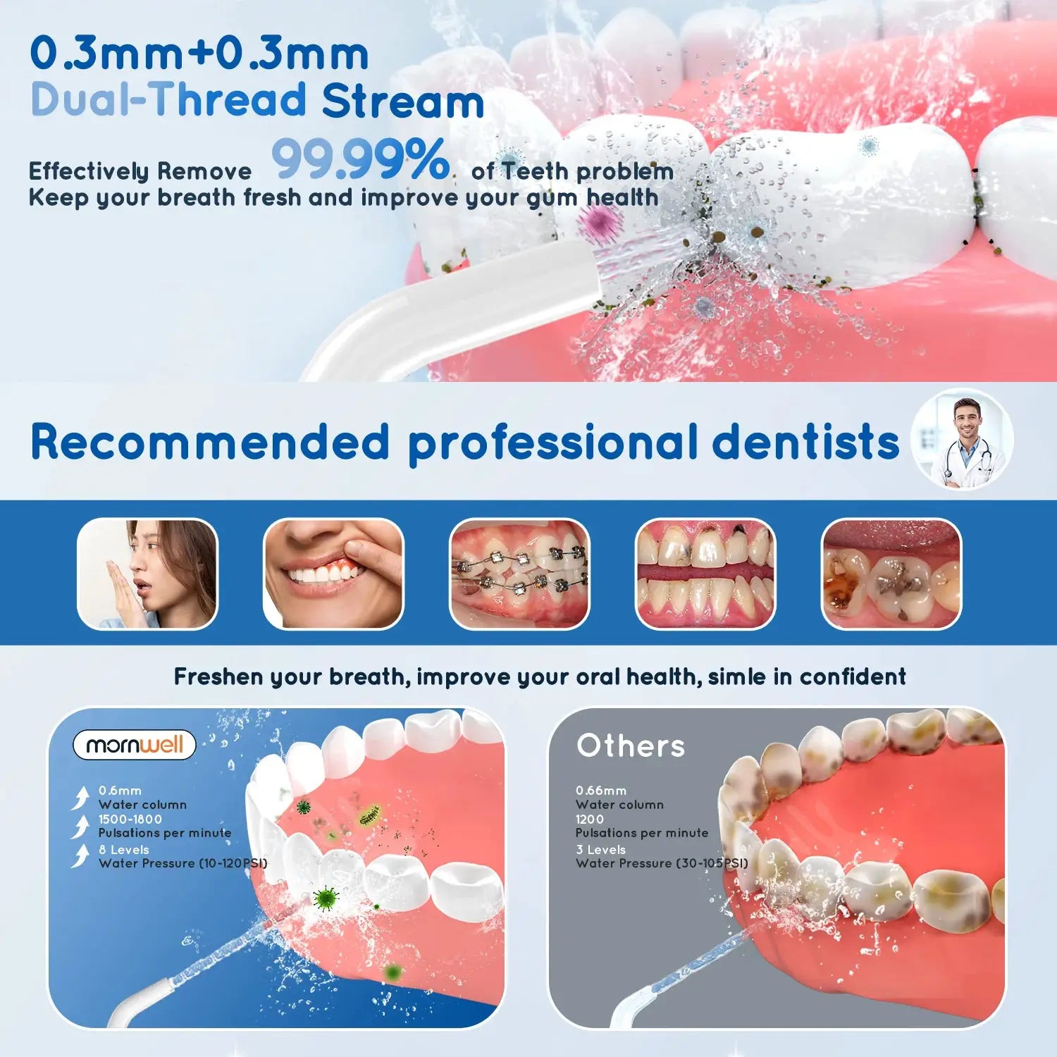 D52 Portable Cordless Water Flosser USB Rechargeable Water Jet Floss Tooth Pick 4 Jet Tip 300ml 3 Modes Teeth Clean for Travel by All Mart Bristol Ltd