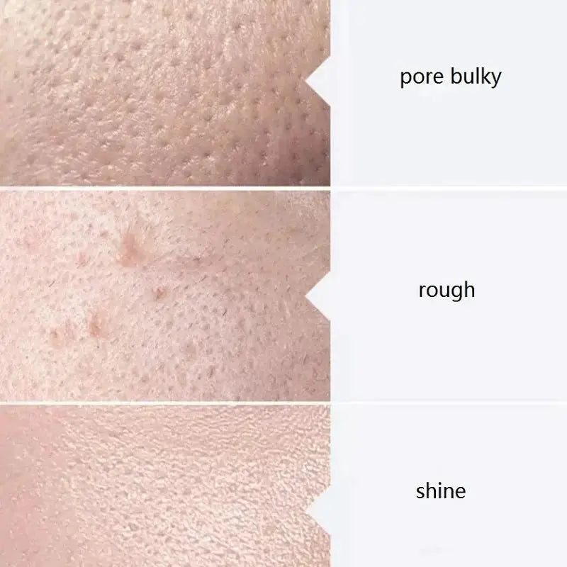 Facial Skincare Face Serum AS1 SA2 AO3 Aqua Peel Solution For Facial Machine Skin Deep Cleaning 400ml Kit of 3 Serums by All Mart Bristol Ltd