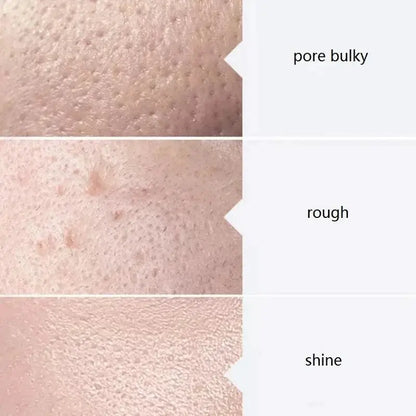 Facial Skincare Face Serum AS1 SA2 AO3 Aqua Peel Solution For Facial Machine Skin Deep Cleaning 400ml Kit of 3 Serums by All Mart Bristol Ltd
