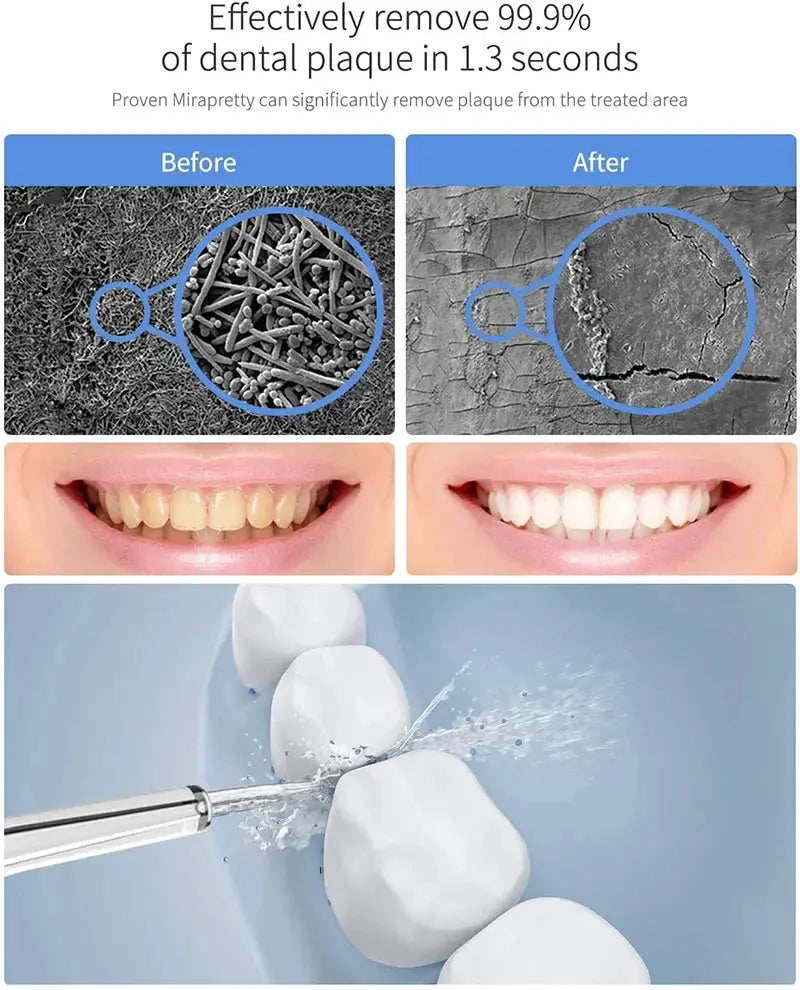 Oral Irrigator Multifunctinal Flosser Tooth Cleaner 600ml Electric Dental Oral Hygiene Water Nozzles 10 Modes 4 Jet Tips IPX7 by All Mart Bristol Ltd